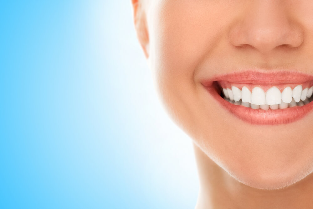 Lentes de Contato Dental Americana